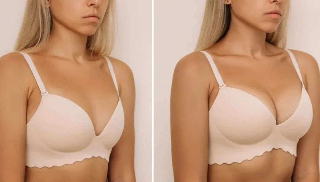 Push Up Bra inserts - before/after